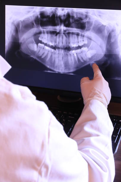 Best Emergency Dentist for Lost Fillings or Crowns in Dash Point, WA