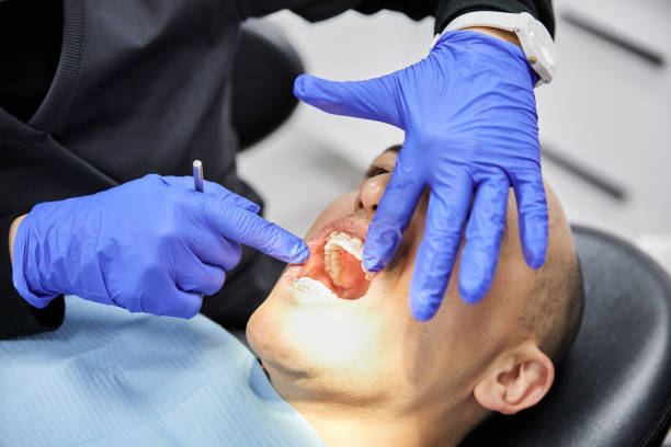 Best Emergency Dentist for Knocked-Out Tooth in Dash Point, WA